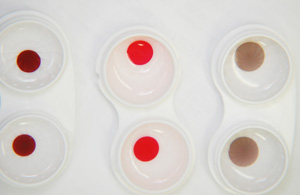 Types-of-Contacts