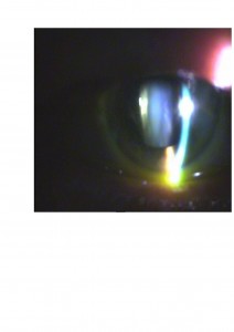 Qvision ¿Cómo podemos ayudar a los pacientes afectados de retinosis pigmentaria? CAT RP 0000