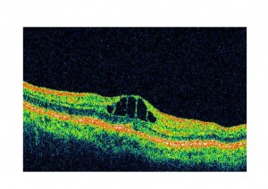Doc1_0000