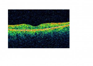 EMQ 2_0000