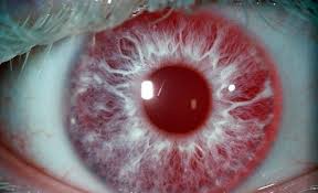 ojo rojo albino