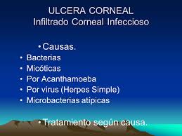 fotos de acanthamoeba