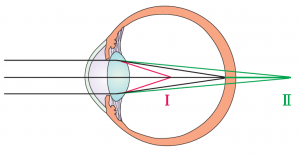 partes del ojo