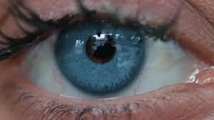 iris artificial