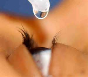 ojo gota