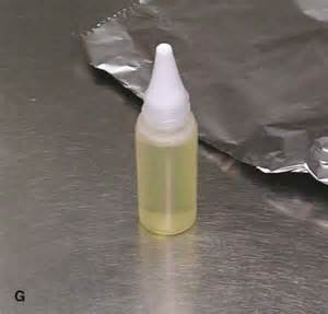 Suero autólogo