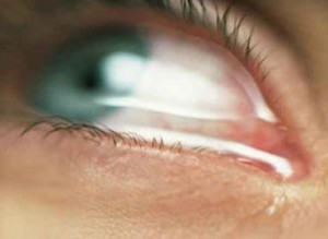 lagrimeo