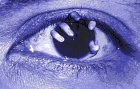 glaucoma
