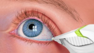 Fuente: solinskyeyecare.com