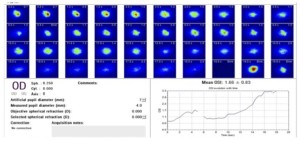 Análisis de imágenes de doble paso