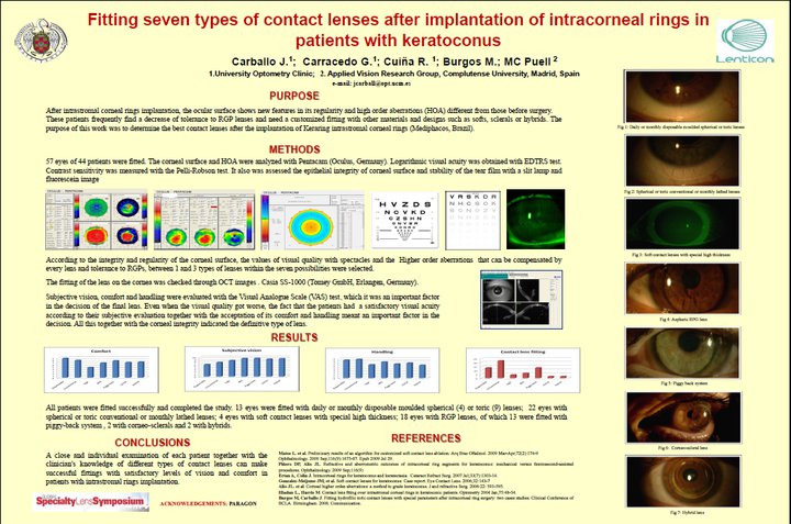Qvision Adaptación de lentes de contacto en pacientes con implante de anillos intraestromales LENTES TRAS kERARING