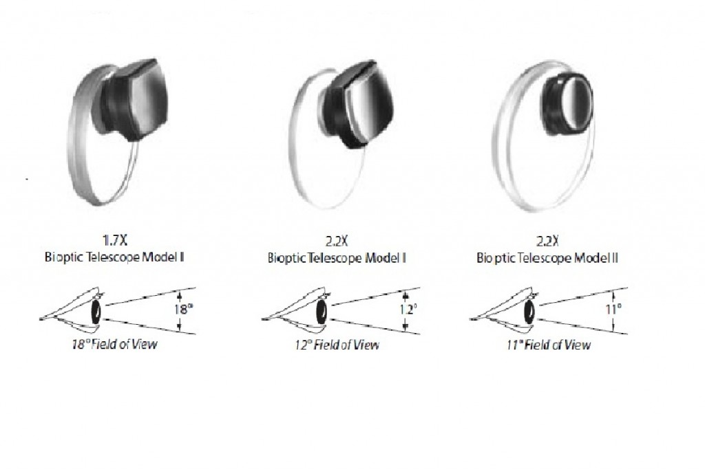 Qvision ¿Qué es un sistema Bióptico? bio