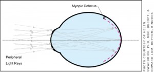 Myopic