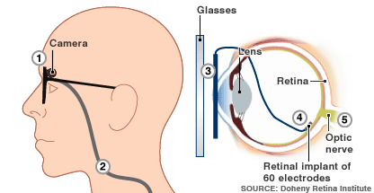 bionic_eye2_416