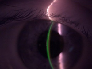 4IQN4IG94O5KUMC2_Esclerales Almeria, Curso OD