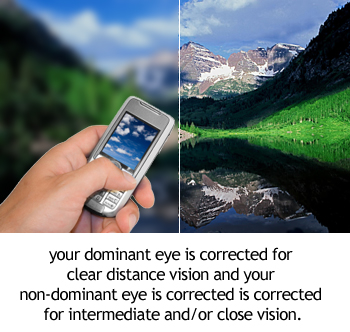 Qvision SUPRACOR: Corrección LASIK de la presbicia (vista cansada) (1/3) monovision