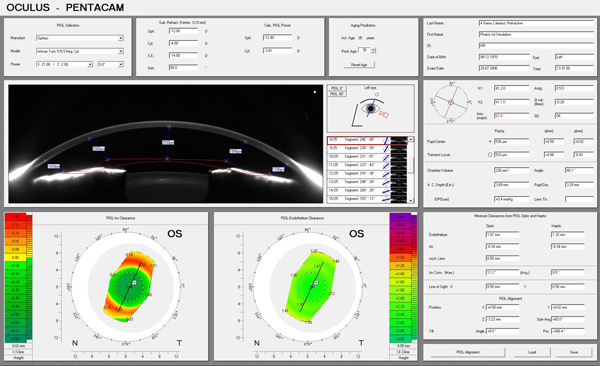 piol_simulation_and_aging_prediction