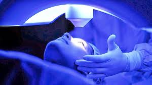 Resultados Visuales tras ReLEx SMILE y Femto-LASIK
