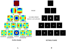Lentes intraoculares monofocales esféricas vs asféricas: comportamiento ante el desalineamiento