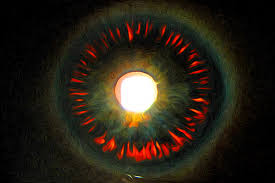 Complicaciones de la lente ICL: Revisión Sistemática y Meta-análisis