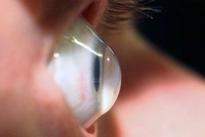 Advanced Vision Surgery