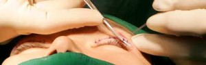 blefaroplastia