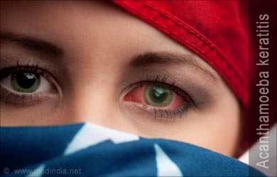 acanthamoeba-keratitis