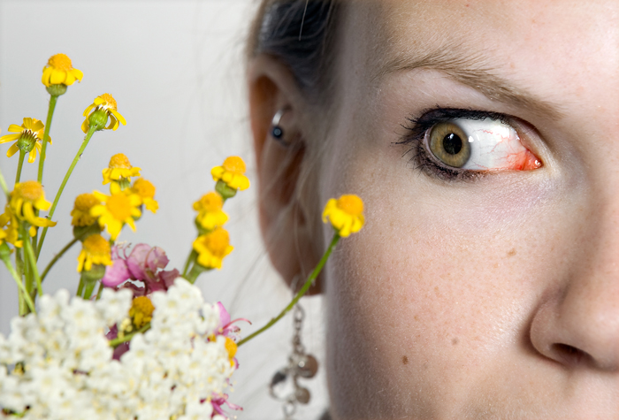 Allergy Illustration