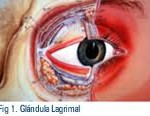 Qvision Sindrome ojo seco Glandula lagrimal
