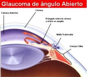 Qvision Ultrasonidos en el tratamiento del glaucoma Cuerpo ciliar