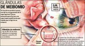 Qvision Disfunción de las glandulas de Meibomio Meibomio 1
