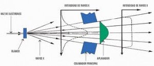 Qvision Rayos X pueden proteger contra el glaucoma rayos x1