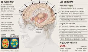 Qvision Deterioro cognitivo, depresión y ansiedad en adultos mayores con glaucoma Alzheimer2