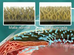 Qvision Tratamiento de glaucoma: Nuevas vías en la terapia genética malla2