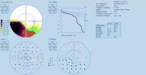 Qvision Glaucoma: Control del equilibrio cv