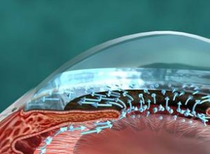 humor