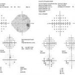 cv