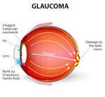 glau