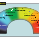Glaucoma