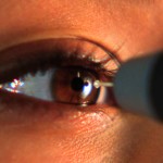 Glaucoma