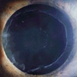 Glaucoma