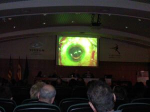 Qvision Presbicia: Soluciones. 256561772