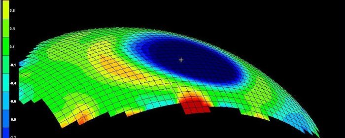 Orto-k: ¿Produce cambios en el grosor corneal?