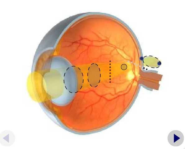 Equivalente esférico, ¿Qué es y cómo se calcula?