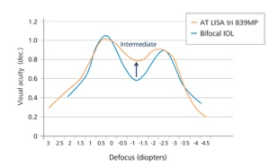 LisaTri: lente intraocular trifocal de ZEISS para presbicia (vista cansada) y catarata
