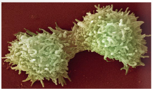 Pseudomona: la importancia de un buen intercambio lagrimal