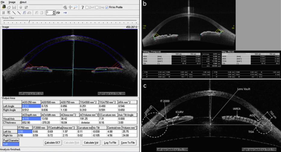 Captura de pantalla 2018-07-01 a las 16.08.20