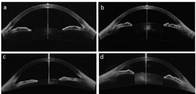 Captura de pantalla 2018-07-01 a las 17.52.30