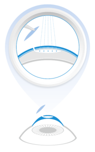 ES_34_065_0001II_SMILE