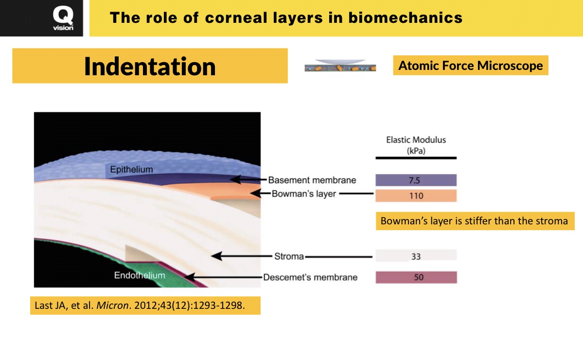 (7/8) Cirugía Refractiva y Biomecánica Corneal: PRK vs LASIK vs ReLEx SMILE (1): La Plausibilidad
